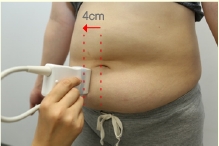 脂肪測定システム